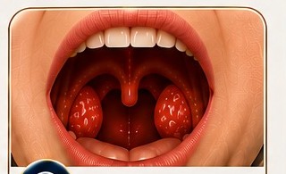 استئصال اللوزتين وإزالة الزوائد خلف الأنف